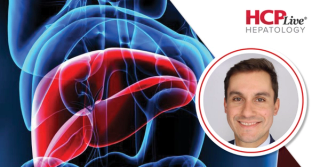 Improving Early Liver Disease Diagnosis With AI ECG, With Doug Simonetto, MD