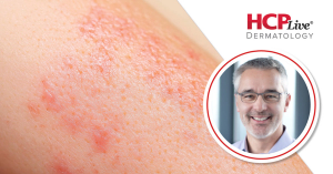 How Well-Being in Psoriasis is Being Assessed Via WHO-5, With Ulrich Mrowietz, MD