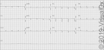 Cardiology Image IQ clinical quiz