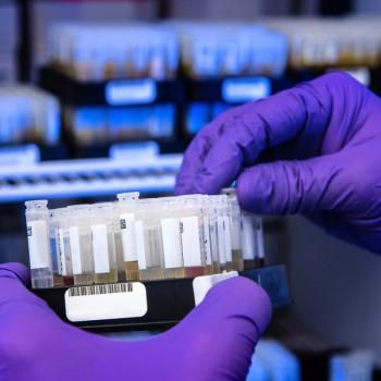 CDC Experts Recommend Single-Visit Hepatitis C Antibody, RNA Testing