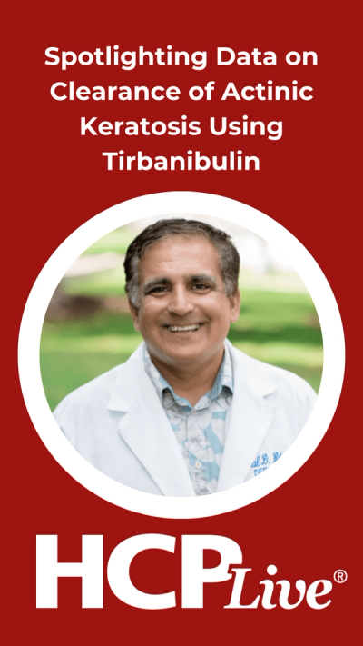 Spotlighting Data on Clearance of Actinic Keratosis Using Tirbanibulin