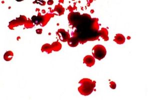16-Year Follow-Up Proves Weekly FVIII Prophylaxis Reduces Bleeding in Hemophilia A
