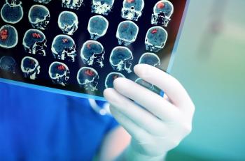 Stroke Survival Much Improved Since 2000