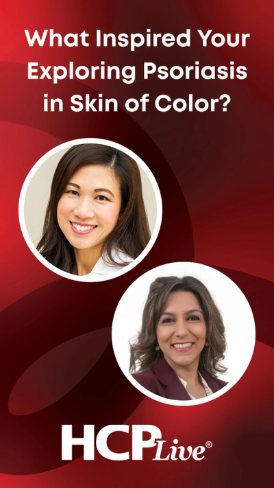 What Inspired Your Exploring Psoriasis in Skin of Color?