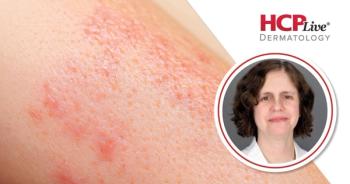 AMETHYST: Litifilimab Sustains CLE Gains at 52 Weeks, With Victoria Werth, MD