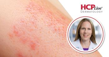 Non-Steroidal Topicals: A Game-Changer for Pediatric Atopic Dermatitis, With Emily Becker, MD