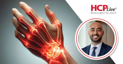 TYK2 Inhibitor Zasocitinib’s Potential for Psoriatic Arthritis, with Andrew Sharobeem, DO