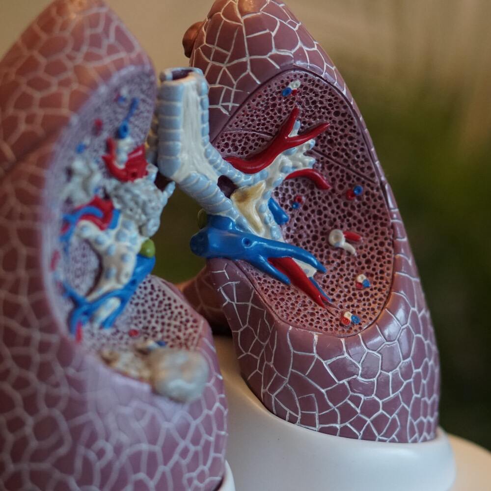 asthma