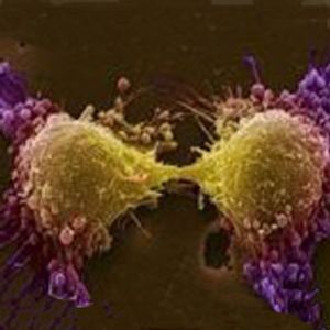 FDA Approves First Immunotherapy Vaccine for Cancer