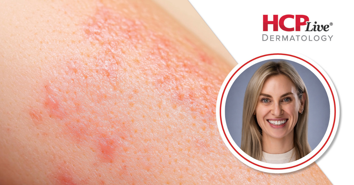 How Environmental Triggers Impact Skin Disease, With Hannah Rodriguez, MPAS, PA-C