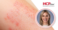 How to Counsel Patients About Skincare Safety, Sunscreen Safety, and Product Ingredients
