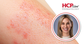 How Environmental Triggers Impact Skin Disease, With Hannah Rodriguez, MPAS, PA-C