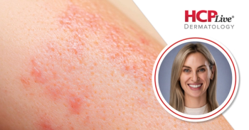 How Environmental Triggers Impact Skin Disease, With Hannah Rodriguez, MPAS, PA-C