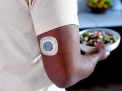 Dexcom Announces Availability, Pricing of Stelo—First OTC Glucose Sensor