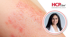 3-Year Nemolizumab Data in Atopic Dermatitis, With Sarina Elmariah, MD, PhD
