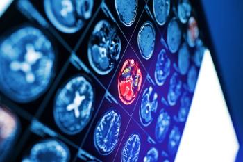 Stimulation Therapy Safe for Some Acute Ischemic Stroke Patients
