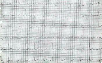 ECG printout