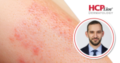 JAK Inhibitors, Oral Minoxidil Reshape Hair Loss Care