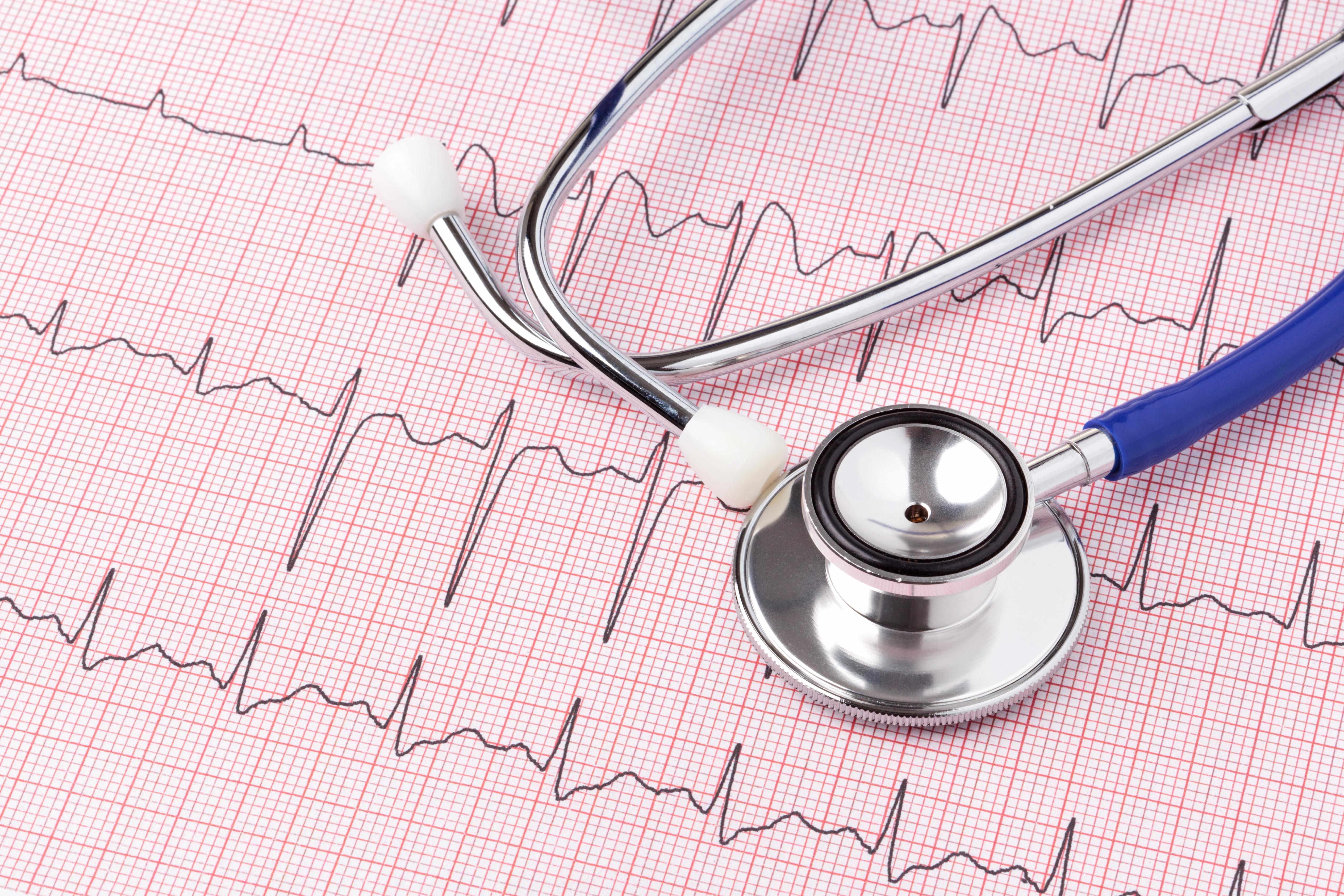 EKG printout and stethoscope.