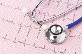 Print out of an EKG reading