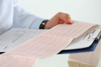 Doctor reading EKG printout.