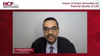 Impact of Atopic Dermatitis on Quality of Life