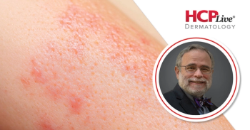 Tips on Billing Issues in Dermatology Practices, With Daniel Siegel, MD