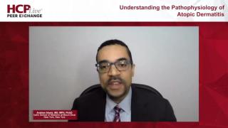 Understanding the Pathophysiology of Atopic Dermatitis