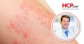 Kilian Eyerich, MD, PhD | Image credit: International Psoriasis Council