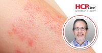 Nonsurgical Skin Cancer Care and New Approvals, With Todd Schlesinger, MD
