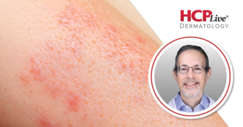 Nonsurgical Skin Cancer Care and New Approvals, With Todd Schlesinger, MD