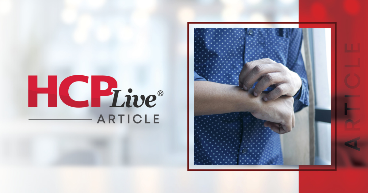 ADMIRE: Upadacitinib Efficacious in Atopic Dermatitis with Prurigo Nodules