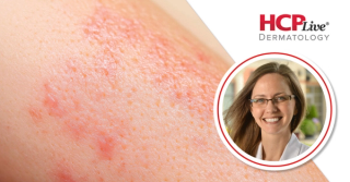When Blisters Don't Look Like Blisters: Diagnosing Pemphigus, Pemphigoid