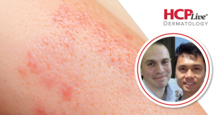 Are Improvements in AI Needed for Dermatology Patients? With Rory Sayres, PhD, and Yun Liu, PhD
