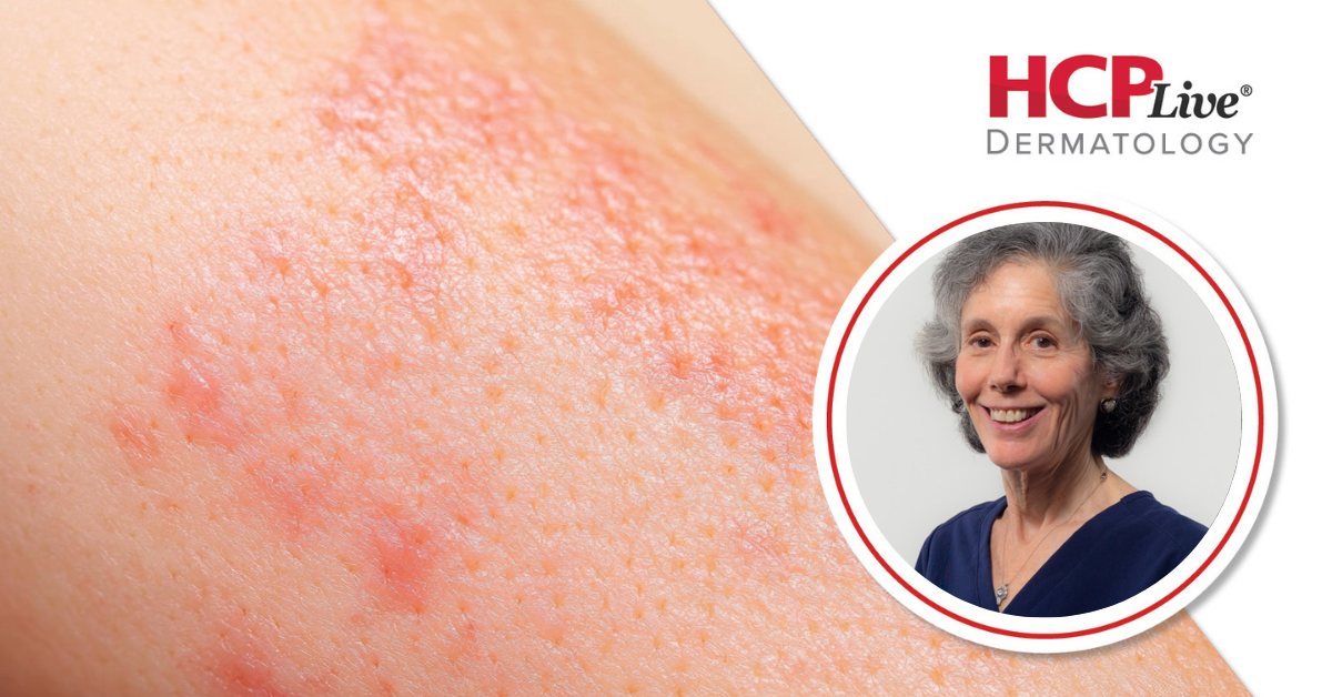 Advice for Evaluating Pregnant Patients in Dermatology, With Jane M. Grant-Kels, MD