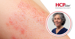 Advice for Evaluating Pregnant Patients in Dermatology, With Jane M. Grant-Kels, MD