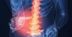 Impact of Psychosocial Factors in Patients with Chronic Low Back Pain