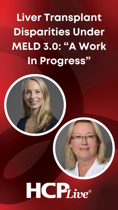 Equity in Liver Transplantation: Addressing MELD 3.0 Disparities