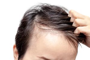 Thyroid Replacement Therapy May Not Offer Long-Term Benefit Hypothyroidism