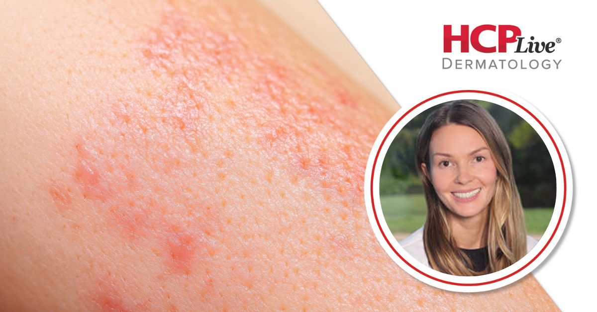 Tips on Patient Communication in Dermatology, With Kassandra Holzem, MD