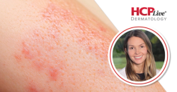 Difficult Cases and Red Flags in Dermatology, With Kassandra Holzem, MD