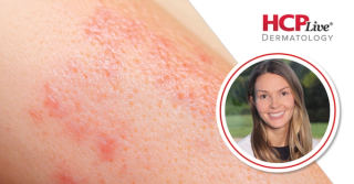Tips on Patient Communication in Dermatology, With Kassandra Holzem, MD