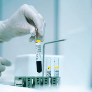 VAS-101 (Vasceptor) Receives Orphan Drug Designation for Sickle Cell Disease | Image Credit: Unsplash