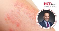 Advances in Treating High-Impact Psoriasis from EADV 2026