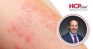 Advances in Treating High-Impact Psoriasis from EADV 2026