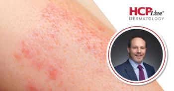 Advances in Treating High-Impact Psoriasis from EADV 2026