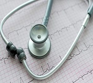 Study Determines Atrial Fibrillation Heritability Among 3 Key Probands
