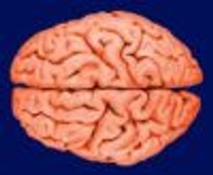 Psychological Issues for Trapped Miners
