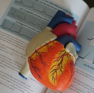 No Signficant Benefit to Dalteparin Bridging in Prevention of Arterial Thromboembolism 