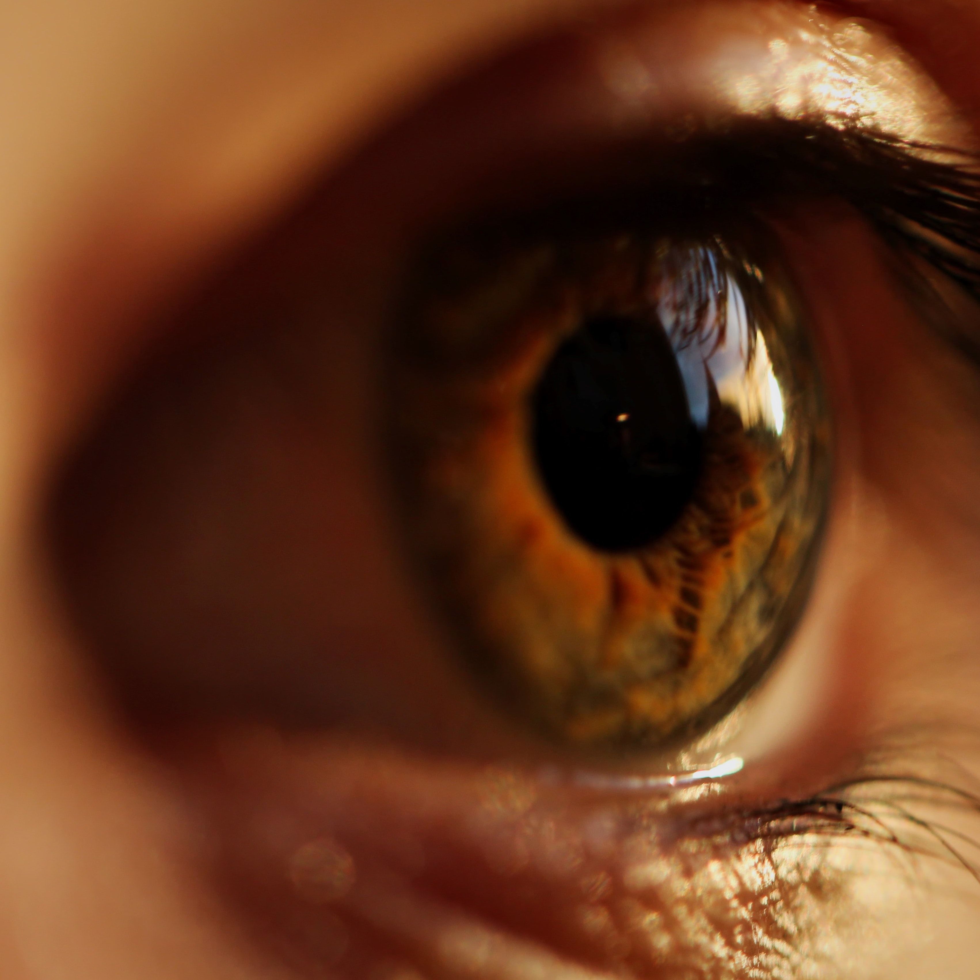 Anti-VEGF Drugs Do Not Differ in RPE Tear Risk for Wet AMD Eyes